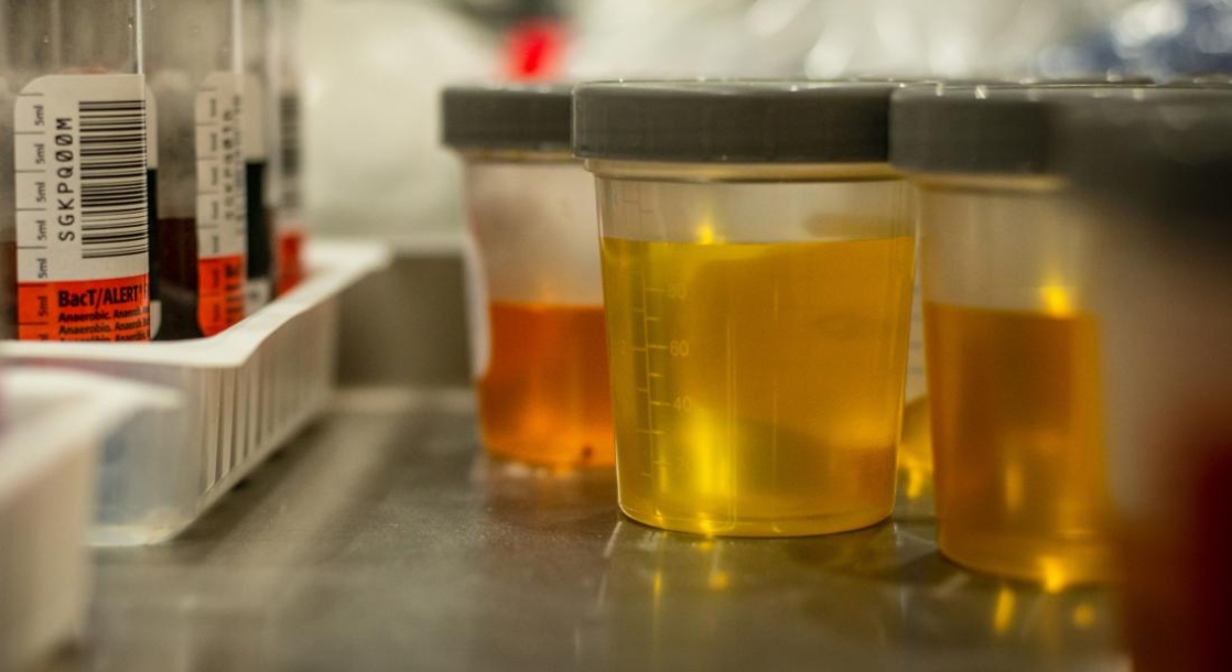 quest diagnostics drug test fake urine
