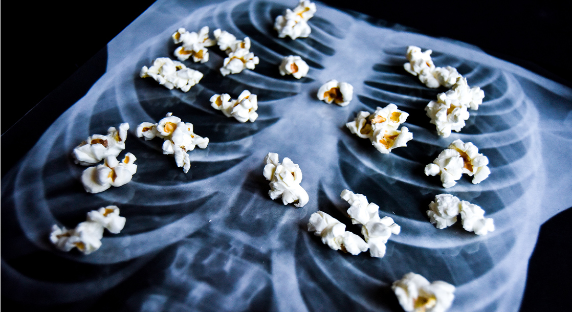 Is This the First Case of “Popcorn Lung” Caused by Vaping?